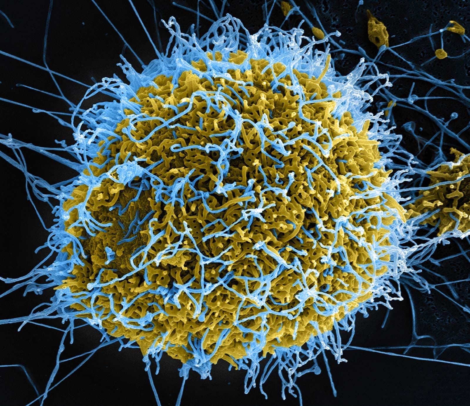 Ebola pandemic in 2026?